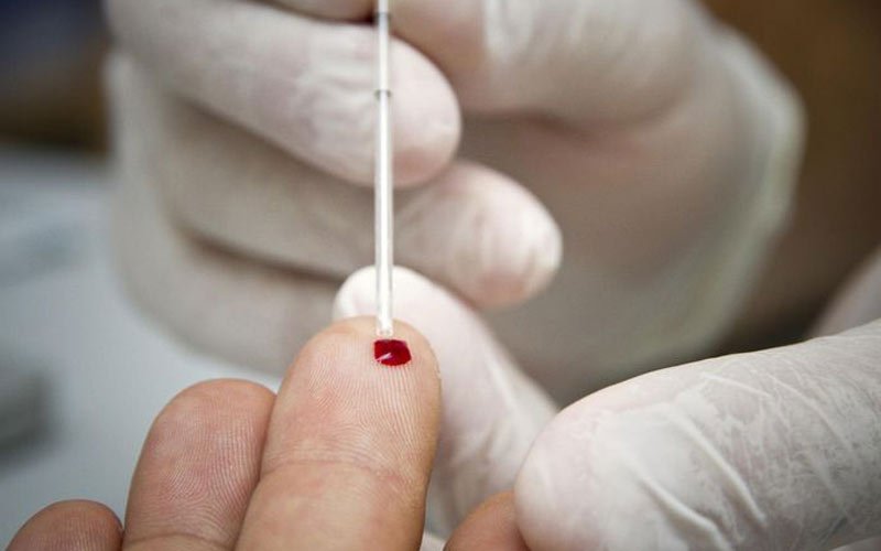 ثلث المغاربة يجهلون إصابتهم بمرض السيدا