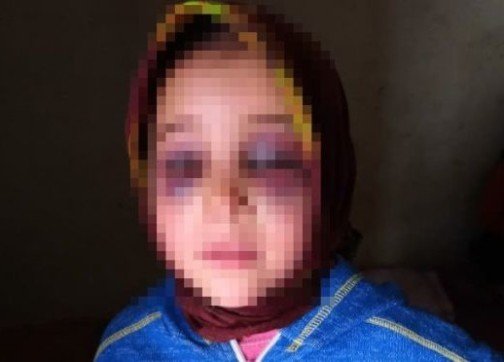 مديرية التعليم بيتارودانت تذخل على خط قضية تعنيف تلميذة من طرف أستاذها