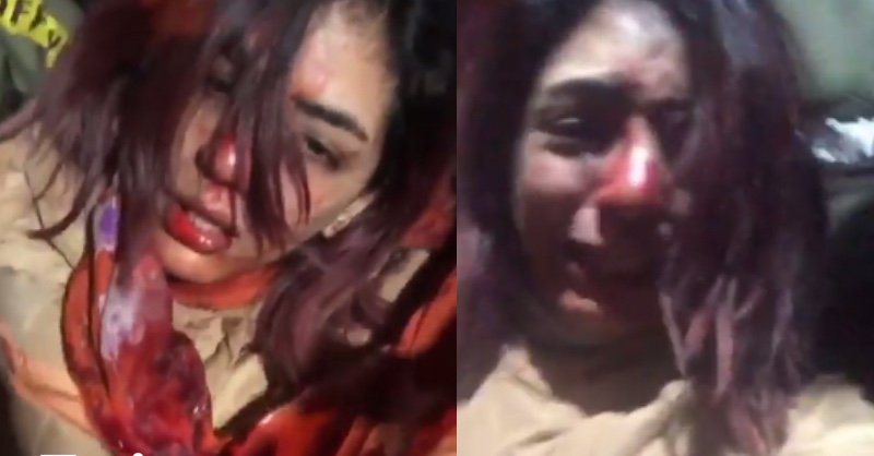 خطير ..دماء وصراخ في اعتداء على مغنية راب بالصخيرات