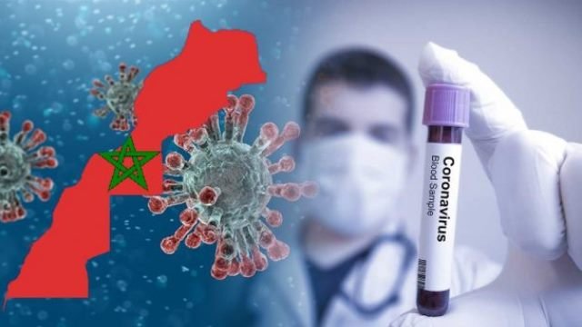 الحصيلة اليومية لوباء كوفيد 19 .. 73 حالة إصابة مؤكدة جديدة