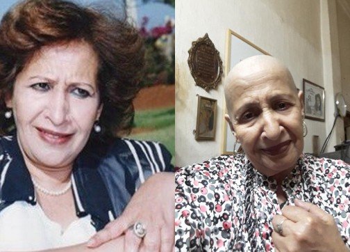 تضامنا مع مرضى السرطان الفنانة  عائشة ماهماه تحلق شعر رأسها