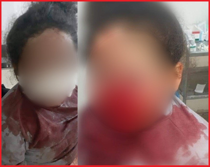 ولاية أمن طنجة تدخل على خط الطفلة التي تعرضت لضربة بالسيف على مستوى الوجه