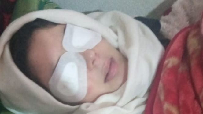 شاب يفقئ عيني شابة بسكين وينتحر بضواحي مكناس