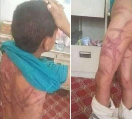 حقيقة تعذيب طفل من طرف زوجة أبيه بجرسيف