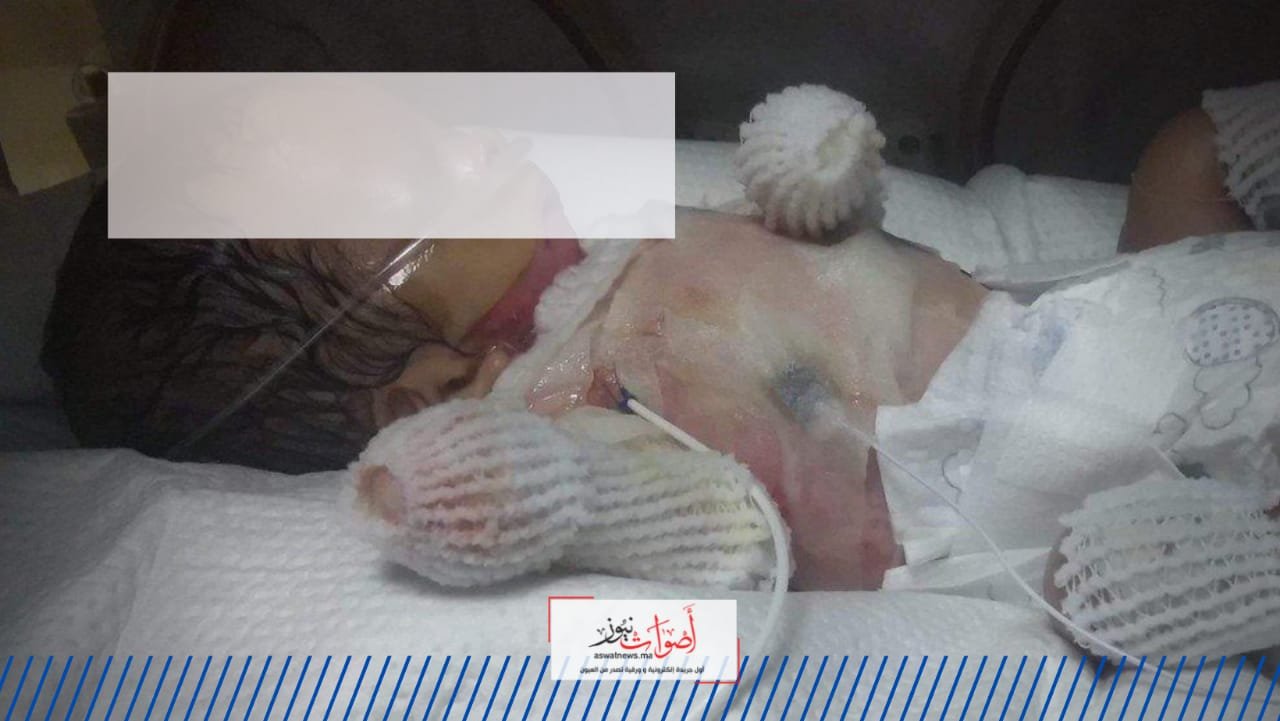 جريمة مروعة تَهُز مكناس ..خال يقدم على رمي رضيع ابنة شقيقته في مياه حارقة حتى الموت