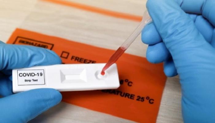 تقنين أسعار الاختبارات الخاصة بكشف فيروس كورونا المستجد