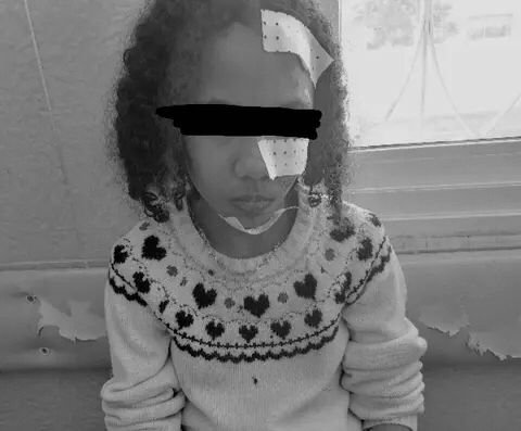 مؤلم..كلاب ضالة تهاجم طفلة صغيرة وتنهش جسدها