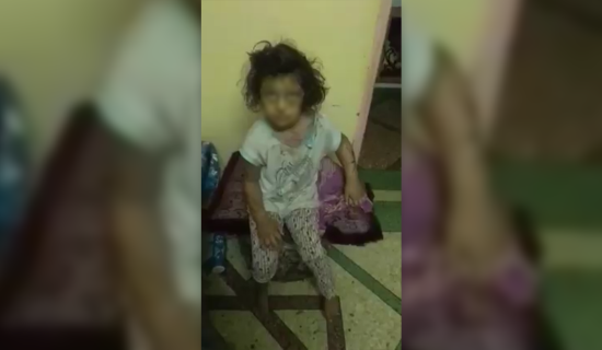 توقيف متهمة في تعذيب طفلتها بالضرب والكي بسلا