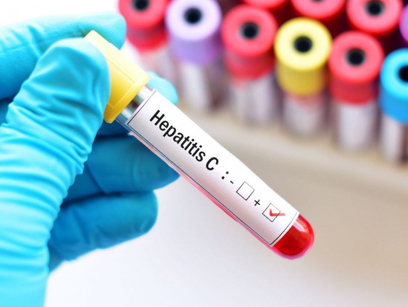 إطلاق الحملة الوطنية للكشف عن التهاب الكبد الفيروسي “س”