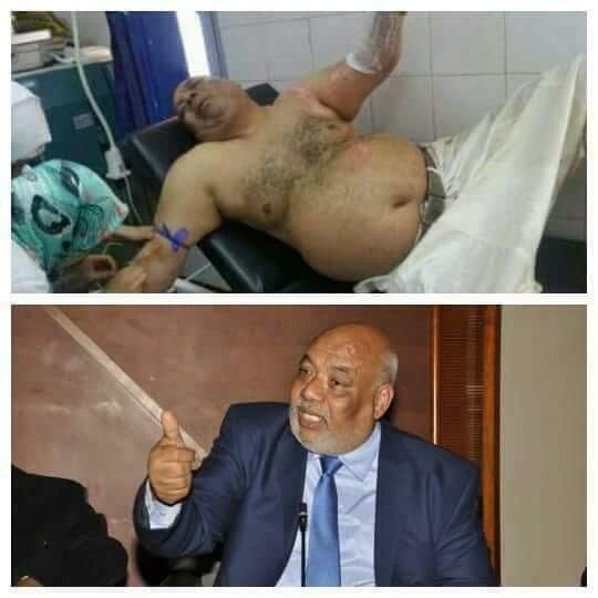 عاااااااااجل و خطيييير.،،برلماني عن البام يشعل النار في جسده احتجاجا على قرار إدارة الفوسفاط..التفاااااااااصيل