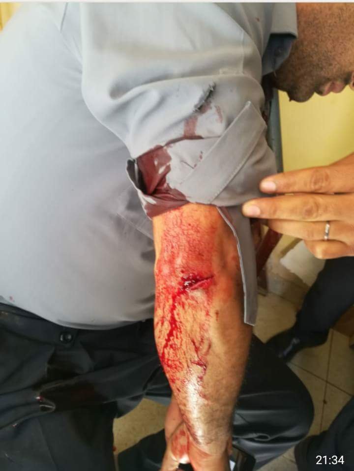 خطييير. سجين سابق يعتدي بسيف على موظف بسجن العيون انتقاماً منه