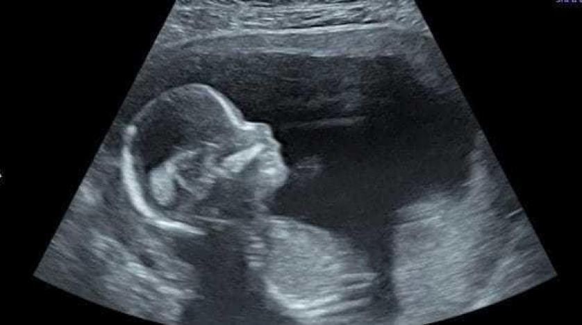 أطباء فرنسيون ينجحون في إجراء جراحة في الدماغ لجنين في بطن أمه