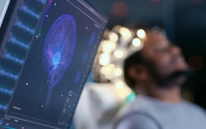 الذكاء الاصطناعي يتنبأ بالزهايمر قبل 7 سنوات من الأعراض