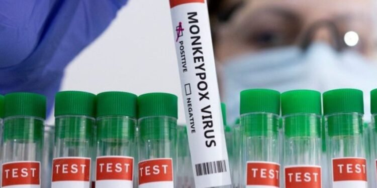 الصحة العالمية تطلق خطة استراتيجية عالمية لاحتواء تفشي جدري القردة